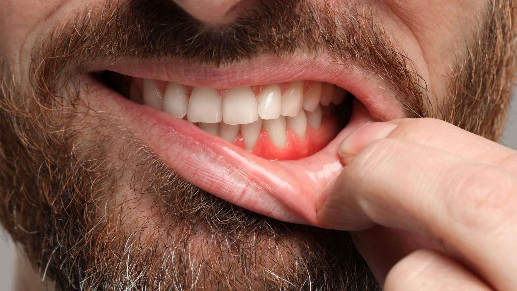 Genives sanes / Foto: CNV