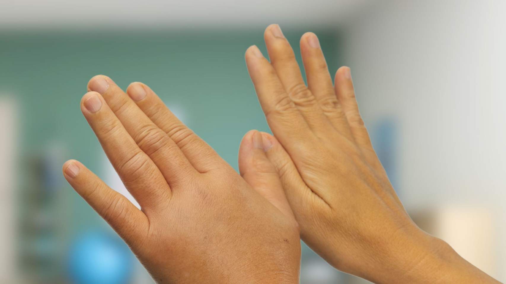 Què és el Síndrome de Sudeck?