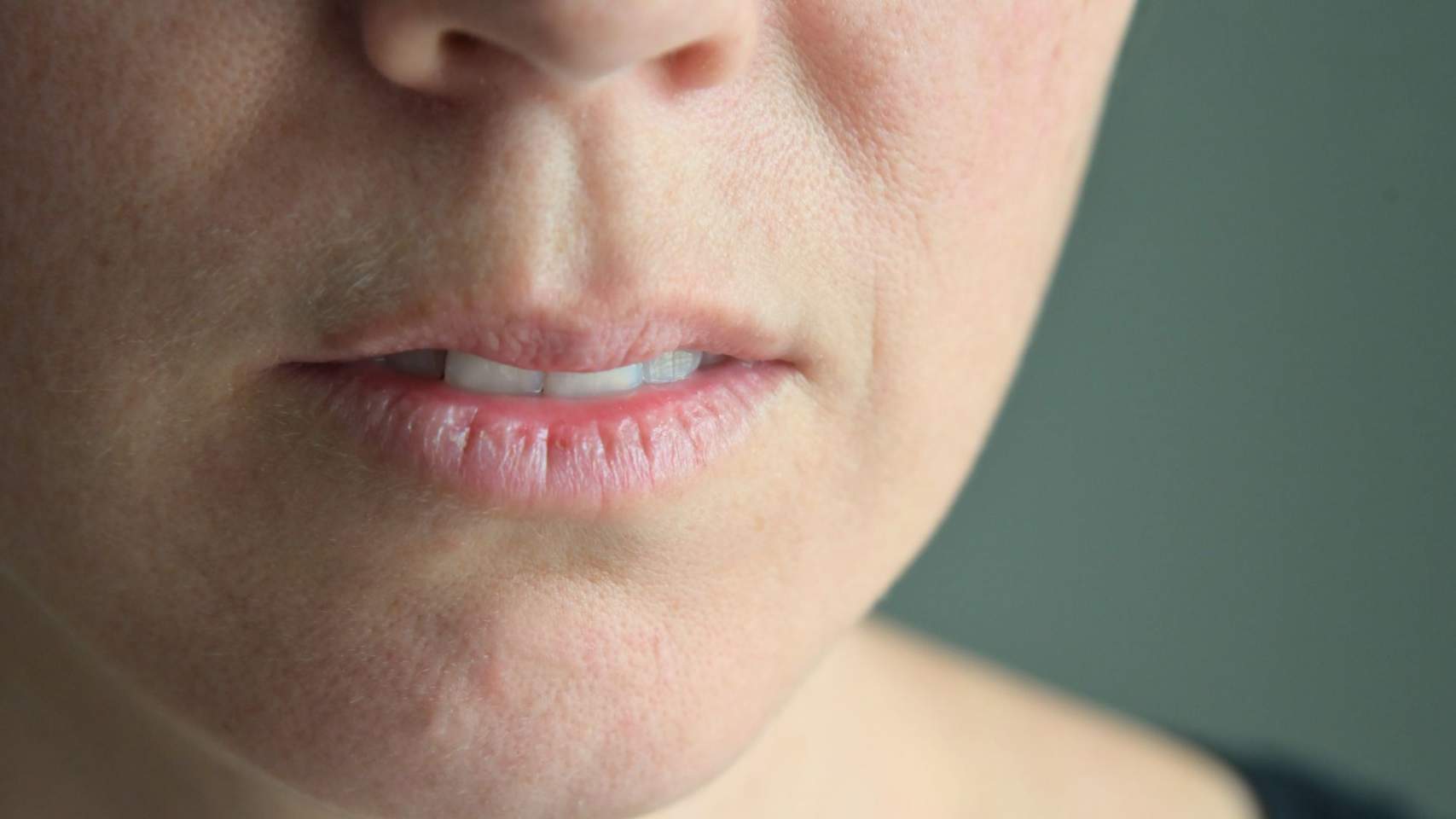 Labios deshidratados y dañados